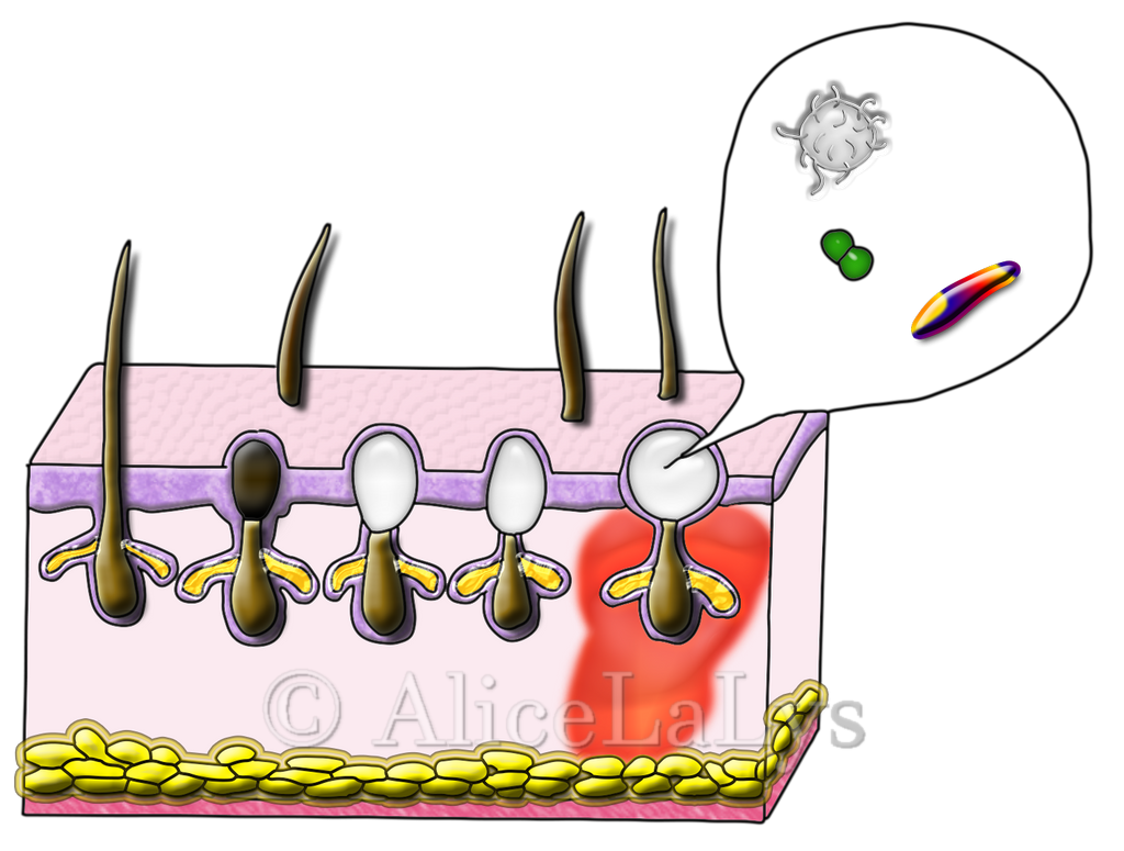 Copyright AliceLaLys Schéma Pores de la peau