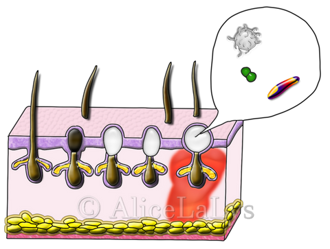 Copyright AliceLaLys Schéma Pores de la peau